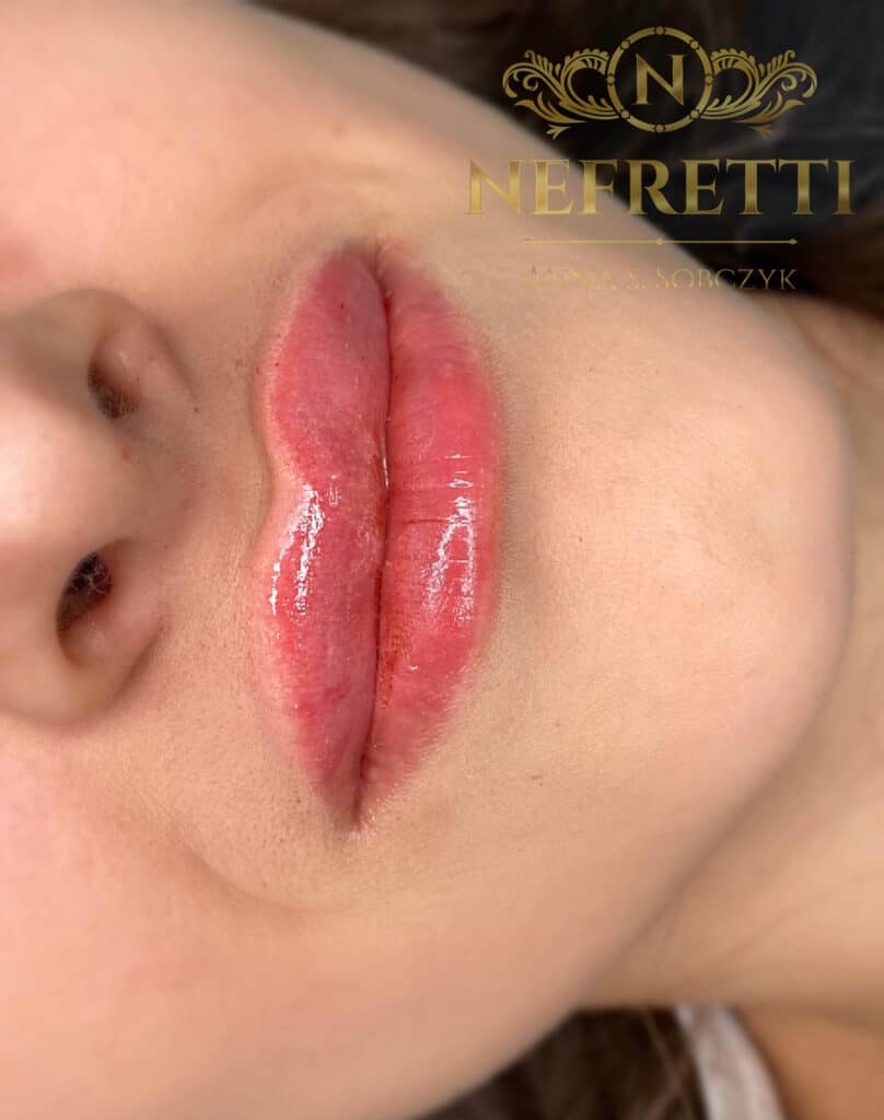 Modelowanie ust salon Nefretti Szczecin