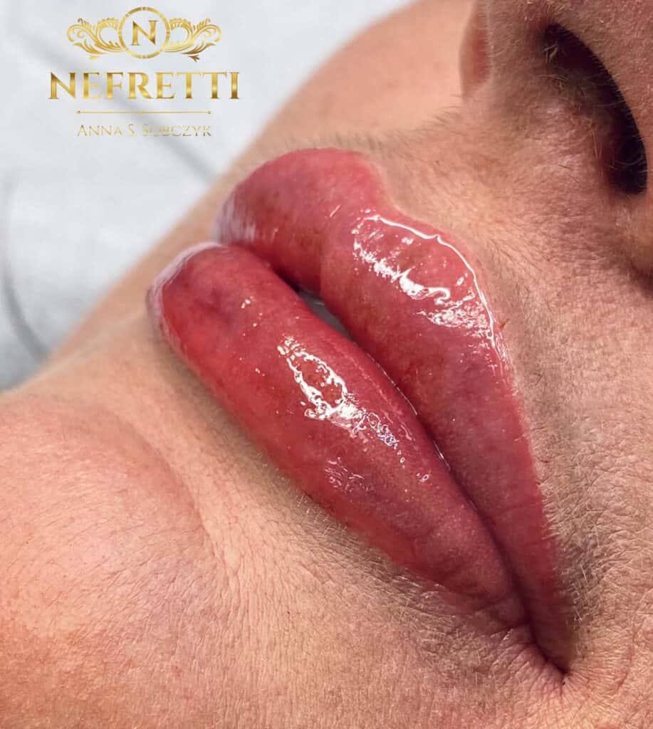 Modelowanie ust salon Nefretti Szczecin